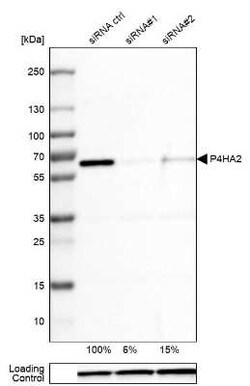 P4HA2 Antibody (CL0351), Novus Biologicals 25 &mu;L, Unconjugated:Antibodies,