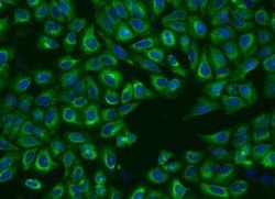 P4HA2 Antibody, Novus Biologicals 50 &mu;g; Unconjugated:Antibodies, Polyclonal