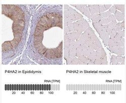 P4HA2 Antibody, Novus Biologicals 25 &mu;L | Buy Online | Novus Biologicals | Fisher Scientific