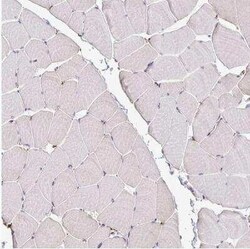 P4HA2 Antibody, Novus Biologicals 25 &mu;L | Buy Online | Novus Biologicals | Fisher Scientific