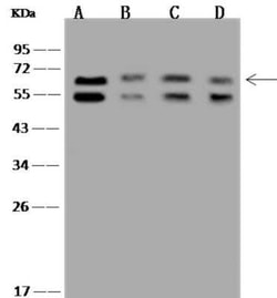 P4HA2 Antibody, Novus Biologicals 50 &mu;g; Unconjugated:Antibodies, Polyclonal
