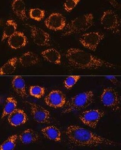P4HA3 Antibody - Azide and BSA Free, Novus Biologicals 0.1 mL; Unconjugated:Antibodies,