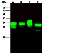 PA28 Activator alpha Subunit/PSME1 Rabbit anti-Human, Clone: 16, Novus