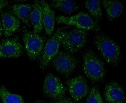 PA28 Activator alpha Subunit/PSME1 Rabbit anti-Human, Mouse, Rat, Clone: