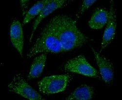 PA28 Activator alpha Subunit/PSME1 Rabbit anti-Human, Mouse, Rat, Clone:
