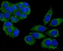 PA28 Activator alpha Subunit/PSME1 Rabbit anti-Human, Mouse, Rat, Clone:
