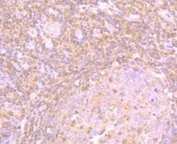 PA28 Activator alpha Subunit/PSME1 Rabbit anti-Human, Mouse, Rat, Clone: