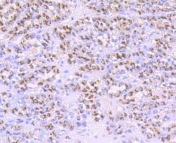PA28 Activator alpha Subunit/PSME1 Rabbit anti-Human, Mouse, Rat, Clone: