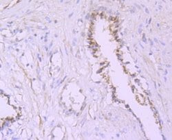 PA28 Activator alpha Subunit/PSME1 Rabbit anti-Human, Mouse, Rat, Clone: