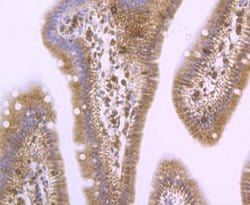 PA28 Activator alpha Subunit/PSME1 Rabbit anti-Human, Mouse, Rat, Clone: