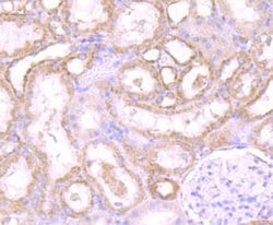 PA28 Activator alpha Subunit/PSME1 Rabbit anti-Human, Mouse, Rat, Clone: