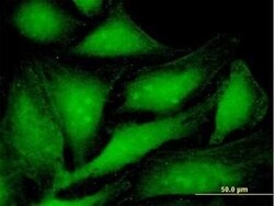 PA28 Activator alpha Subunit/PSME1 Antibody, Novus Biologicals 0.05 mg | Buy Online | Novus Biologicals | Fisher Scientific