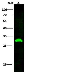 PA28 Activator beta Subunit/PSME2 Antibody (06), Novus Biologicals:Antibodies:Primary