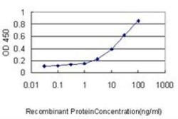 PA28 Activator beta Subunit/PSME2 Antibody (1G4), Novus Biologicals 0.1 mg | Buy Online | Novus Biologicals | Fisher Scientific