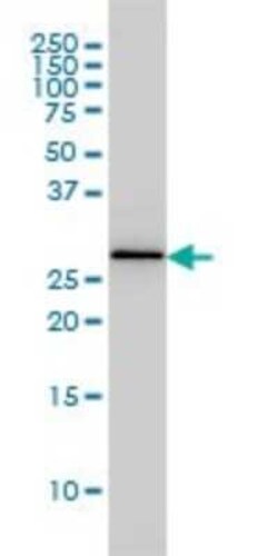 PA28 Activator beta Subunit/PSME2 Antibody (1G4), Novus Biologicals 0.1 mg | Buy Online | Novus Biologicals | Fisher Scientific