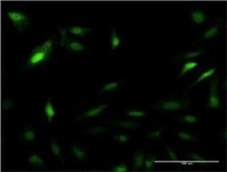 PA28 Activator beta Subunit/PSME2 Antibody (3F11-1A3), Novus Biologicals 0.1 mg | Buy Online | Novus Biologicals | Fisher Scientific