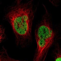 PA28 Activator gamma Subunit/PSME3 Antibody, Novus Biologicals:Antibodies:Primary