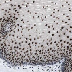 PA28 Activator gamma Subunit/PSME3 Antibody, Novus Biologicals:Antibodies:Primary