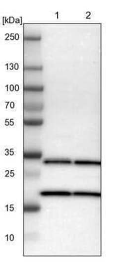 PA28 Activator gamma Subunit/PSME3 Antibody, Novus Biologicals:Antibodies:Primary