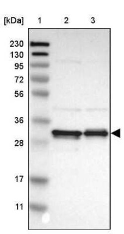 PA28 Activator gamma Subunit/PSME3 Antibody, Novus Biologicals:Antibodies:Primary