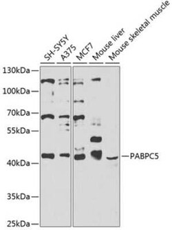 PABPC5 Antibody - BSA Free, Novus Biologicals:Antibodies:Primary Antibodies