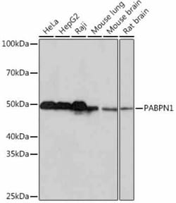 PABPN1 Rabbit anti-Human, Mouse, Rat, Clone: 7V4X8, Novus Biologicals 20
