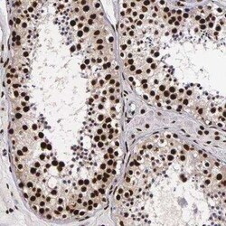 PABPN1 Antibody, Novus Biologicals 0.1 mL; Unconjugated:Antibodies, Polyclonal