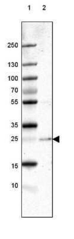 PABPN1 Antibody, Novus Biologicals 0.1 mL; Unconjugated:Antibodies, Polyclonal