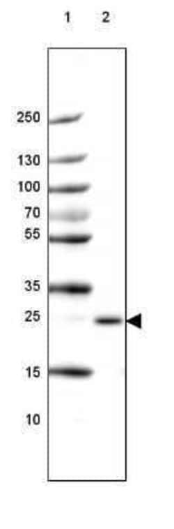 PABPN1 Antibody, Novus Biologicals 0.1 mL; Unconjugated:Antibodies, Polyclonal