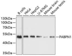 PABPN1 Antibody - BSA Free, Novus Biologicals:Antibodies:Primary Antibodies