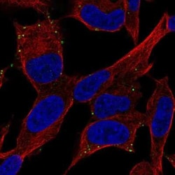 PAC1R Antibody, Novus Biologicals 100 &mu;g | Buy Online | Novus Biologicals | Fisher Scientific