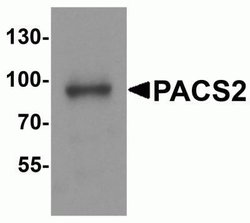 PACS2 Antibody - BSA Free, Novus Biologicals 0.1 mg; Unconjugated:Antibodies,
