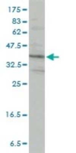 PACT Antibody (1B9-1A7), Novus Biologicals 0.1 mg | Buy Online | Novus Biologicals | Fisher Scientific
