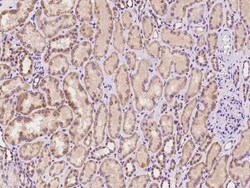 PAD3 Antibody, Novus Biologicals 50 &mu;g, Unconjugated:Antibodies, Polyclonal