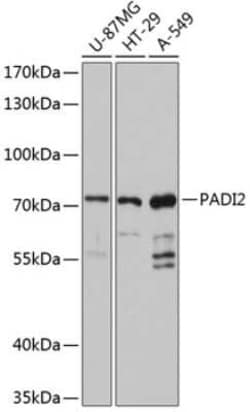 PADI2 Antibody - Azide and BSA Free, Novus Biologicals 0.1 mL; Unconjugated:Antibodies,
