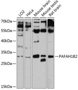 PAFAH1B2 Antibody - Azide and BSA Free, Novus Biologicals:Antibodies:Primary