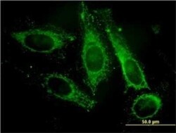 PAFAH1B3 Antibody (8C11), Novus Biologicals 0.1 mg | Buy Online | Novus Biologicals | Fisher Scientific