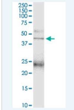 Novus Biologicals PAFR Antibody, Novus Biologicals 50 &mu;g | Buy Online | Novus Biologicals&trade; | Fisher Scientific