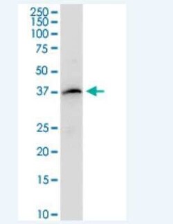Novus Biologicals PAFR Antibody, Novus Biologicals 50 &mu;g | Buy Online | Novus Biologicals&trade; | Fisher Scientific