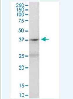 Novus Biologicals PAFR Antibody, Novus Biologicals 50 &mu;g | Buy Online | Novus Biologicals&trade; | Fisher Scientific