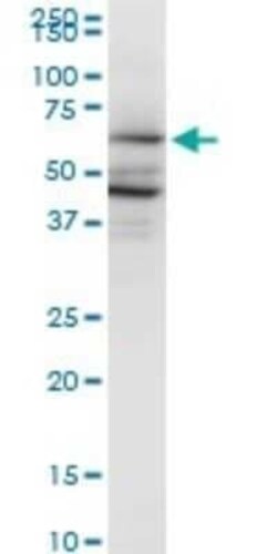 PAIP1 Antibody (2D11), Novus Biologicals 50 &mu;g | Buy Online | Novus Biologicals | Fisher Scientific