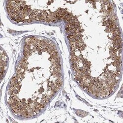 PAIP1 Antibody, Novus Biologicals:Antibodies:Primary Antibodies