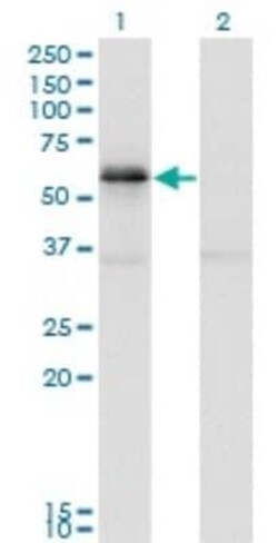 PAK1 Antibody (4D1), Novus Biologicals 0.1 mg | Buy Online | Novus Biologicals | Fisher Scientific