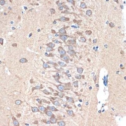 PAK3 Rabbit anti-Human, Mouse, Rat, Clone: 0K1I5, Novus Biologicals 100