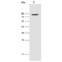 PAK6 Antibody, Novus Biologicals:Anticuerpos:Anticuerpos primarios