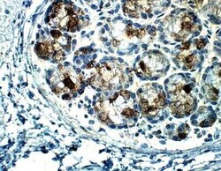 PALB2 Antibody, Novus Biologicals 100 &mu;g; Unconjugated:Antibodies, Polyclonal