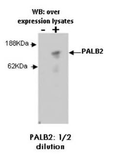 PALB2 Antibody (M41-P3F3) - BSA Free, Novus Biologicals:Antibodies:Primary
