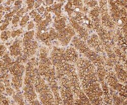 PALMD Antibody, Novus Biologicals 50 &mu;g | Buy Online | Novus Biologicals | Fisher Scientific