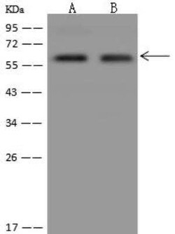 PALMD Antibody, Novus Biologicals 50 &mu;g | Buy Online | Novus Biologicals | Fisher Scientific