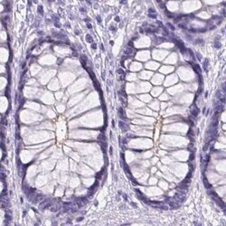 PALS1/MPP5 Antibody, Novus Biologicals 100 &mu;g; Unconjugated:Antibodies,
